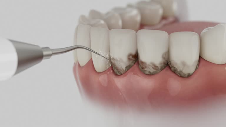 Trusted Wisdom Tooth Removal service in Strawberry Point, IA - Dentist Open Now